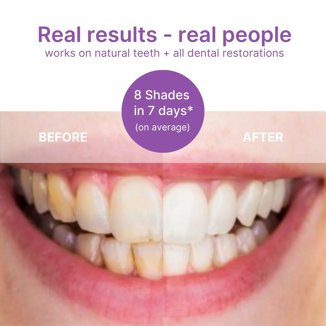 Fang® At-Home Teeth Whitening Strips v34 for Sensitive teeth - Image 5