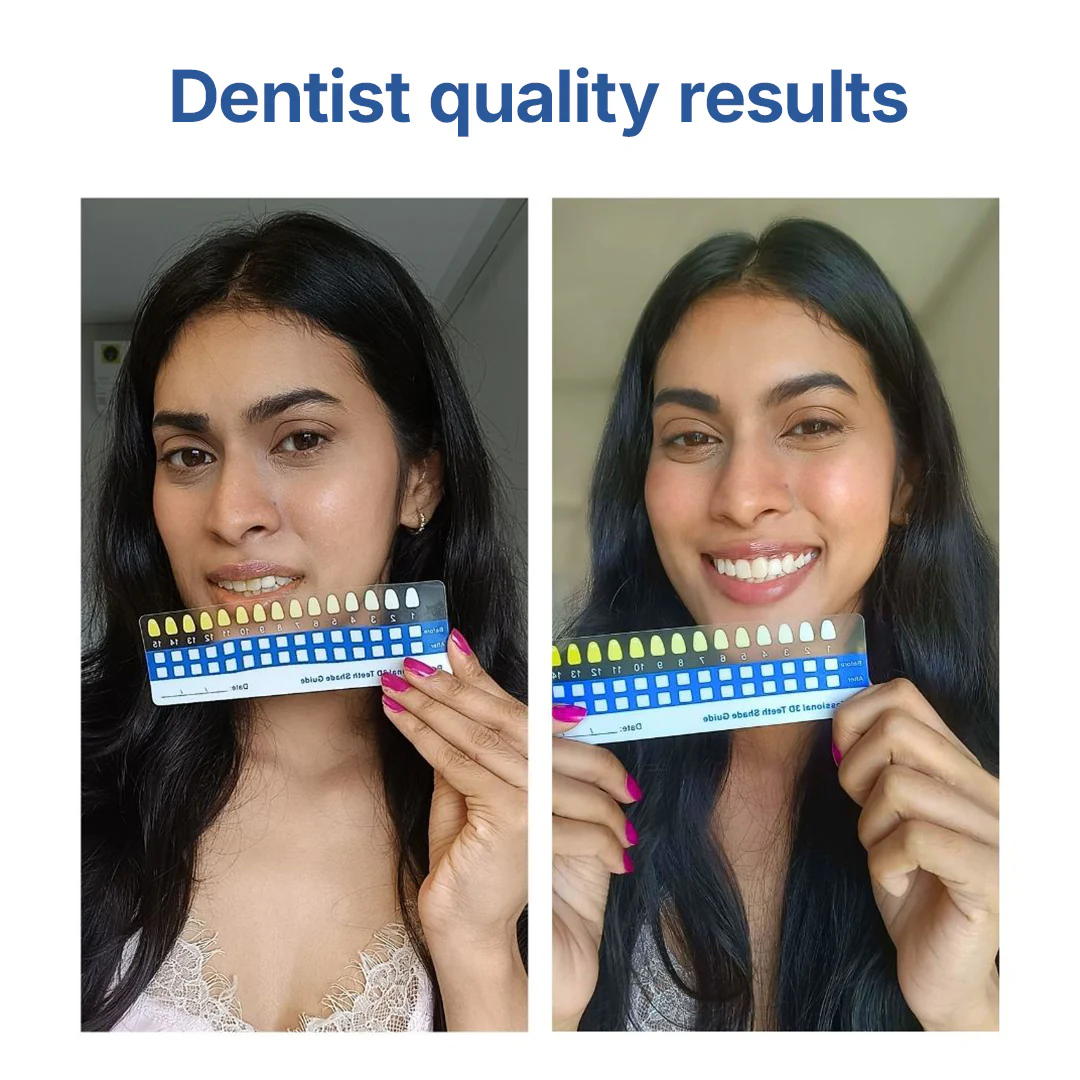 Fang® At-Home Teeth Whitening Pen - Image 4